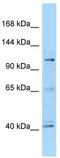 Histone Deacetylase 4 antibody, TA332046, Origene, Western Blot image 