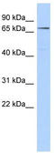 ClpB Homolog, Mitochondrial AAA ATPase Chaperonin antibody, TA335442, Origene, Western Blot image 