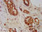 GDP-Mannose 4,6-Dehydratase antibody, LS-C671389, Lifespan Biosciences, Immunohistochemistry paraffin image 