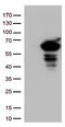 Sequestosome 1 antibody, LS-C796673, Lifespan Biosciences, Western Blot image 