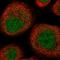 UEV And Lactate/Malate Dehyrogenase Domains antibody, HPA047134, Atlas Antibodies, Immunofluorescence image 