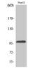 DNA Topoisomerase III Beta antibody, STJ96063, St John