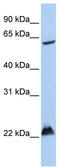 Mahogunin Ring Finger 1 antibody, TA329849, Origene, Western Blot image 