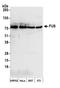 FUS RNA Binding Protein antibody, A300-302A, Bethyl Labs, Western Blot image 