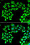 TIMP Metallopeptidase Inhibitor 4 antibody, 22-204, ProSci, Immunofluorescence image 