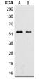 Serum/Glucocorticoid Regulated Kinase 1 antibody, GTX32413, GeneTex, Western Blot image 