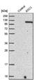 Amine Oxidase Copper Containing 3 antibody, NBP1-89671, Novus Biologicals, Western Blot image 