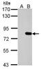 SLU7 Homolog, Splicing Factor antibody, NBP2-20402, Novus Biologicals, Western Blot image 