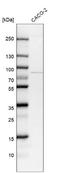 Treacher Collins syndrome protein antibody, NBP1-86909, Novus Biologicals, Western Blot image 