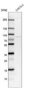 Treacle Ribosome Biogenesis Factor 1 antibody, NBP1-86909, Novus Biologicals, Western Blot image 