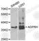 ARH1 antibody, A6277, ABclonal Technology, Western Blot image 