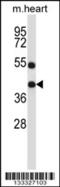 Deltex E3 Ubiquitin Ligase 3 antibody, 57-066, ProSci, Western Blot image 