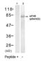 Eukaryotic Translation Initiation Factor 4B antibody, GTX79088, GeneTex, Western Blot image 