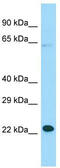 Motile Sperm Domain Containing 1 antibody, TA334328, Origene, Western Blot image 