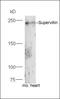 Supervillin antibody, orb158523, Biorbyt, Western Blot image 