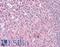 Protein Kinase C Delta antibody, LS-B7634, Lifespan Biosciences, Immunohistochemistry paraffin image 