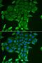 CD84 Molecule antibody, LS-C334717, Lifespan Biosciences, Immunofluorescence image 
