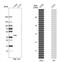 Microtubule Associated Protein RP/EB Family Member 2 antibody, NBP1-84926, Novus Biologicals, Western Blot image 