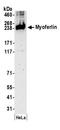 Myoferlin antibody, A304-387A, Bethyl Labs, Western Blot image 