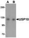 Ubiquitin Specific Peptidase 10 antibody, NBP1-77170, Novus Biologicals, Western Blot image 