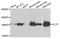 Clathrin Heavy Chain antibody, A03134, Boster Biological Technology, Western Blot image 