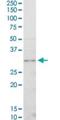 Cyclin Dependent Kinase 4 antibody, H00001019-M03, Novus Biologicals, Western Blot image 