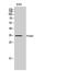 Prostaglandin Reductase 2 antibody, STJ95261, St John