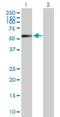 Carboxypeptidase Q antibody, H00010404-B01P, Novus Biologicals, Western Blot image 