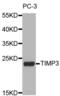 TIMP Metallopeptidase Inhibitor 3 antibody, abx001273, Abbexa, Western Blot image 