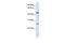 Transmembrane protein 127 antibody, GTX46321, GeneTex, Western Blot image 