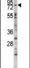 Myosin Light Chain Kinase 3 antibody, PA5-15176, Invitrogen Antibodies, Western Blot image 