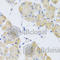 CAP-Gly Domain Containing Linker Protein 1 antibody, A7722, ABclonal Technology, Immunohistochemistry paraffin image 