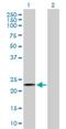 Potassium Voltage-Gated Channel Subfamily E Regulatory Subunit 1 antibody, H00003753-B01P, Novus Biologicals, Western Blot image 