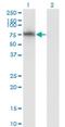 ADAM Metallopeptidase Domain 2 antibody, H00002515-M02, Novus Biologicals, Western Blot image 