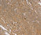 Tyrosine-protein phosphatase non-receptor type 20 antibody, MBS2526372, MyBioSource, Immunohistochemistry paraffin image 