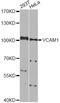 Vascular Cell Adhesion Molecule 1 antibody, MBS126105, MyBioSource, Western Blot image 