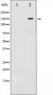 c-met antibody, abx011908, Abbexa, Western Blot image 