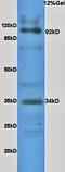BCL2 Associated Agonist Of Cell Death antibody, orb10175, Biorbyt, Western Blot image 
