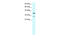 Zinc Finger Protein 385A antibody, 27-628, ProSci, Western Blot image 