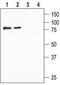 Sodium Channel Epithelial 1 Beta Subunit antibody, TA329042, Origene, Western Blot image 