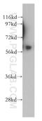 Suppressor Of Cytokine Signaling 7 antibody, 12425-1-AP, Proteintech Group, Western Blot image 