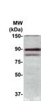 Metastasis-associated protein MTA2 antibody, TA354430, Origene, Western Blot image 