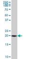 VHL Binding Protein 1 antibody, H00007411-B01P, Novus Biologicals, Western Blot image 