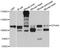 EPH Receptor A8 antibody, abx125819, Abbexa, Western Blot image 
