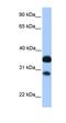 Gamma-aminobutyric acid receptor subunit beta-2 antibody, orb329805, Biorbyt, Western Blot image 