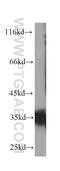 CD7 Molecule antibody, 60209-2-Ig, Proteintech Group, Western Blot image 