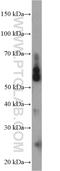 NIMA Related Kinase 3 antibody, 12843-1-AP, Proteintech Group, Western Blot image 