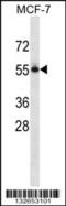 Nectin Cell Adhesion Molecule 3 antibody, 56-704, ProSci, Western Blot image 