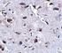 Regulator Of Calcineurin 2 antibody, NBP1-76995, Novus Biologicals, Immunohistochemistry frozen image 