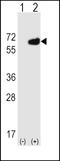 5'-Nucleotidase Ecto antibody, LS-B3428, Lifespan Biosciences, Western Blot image 